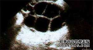 有人供卵试管吗-哪里可以找到供卵试管_中国做试管代孕的要求-三代试管代孕过