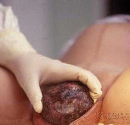 北京包成功代孕产子价格-北京妇幼保健院人工代孕一次费用-妇幼试管代怀流程