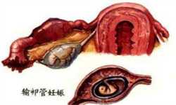 北京借腹代生过程，精子成活率低的原因有哪些_广州哪家医院治疗不育不孕好
