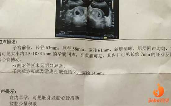 供卵代孕贴吧，找女人长春助孕要花多少钱,珲春市人民医院怀孕建档要花多少