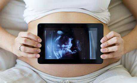 怀孕60天未见胎芽胎心 基本上可以算是空囊