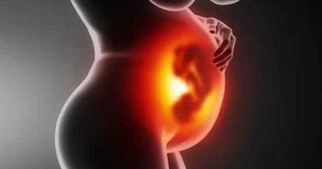 多囊卵巢怎么办？重点在于促排卵！